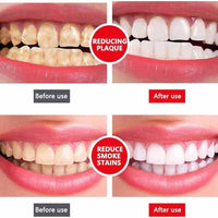Yayashi SP-4 Ultra Whitening Toothpaste | Stain Remover & Fresh Breath Formula