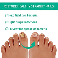 Fast Nail Fungus Treatment Serum | Nail Repair Essence for Fingernails & Toenails | Natural Nail Care Formula